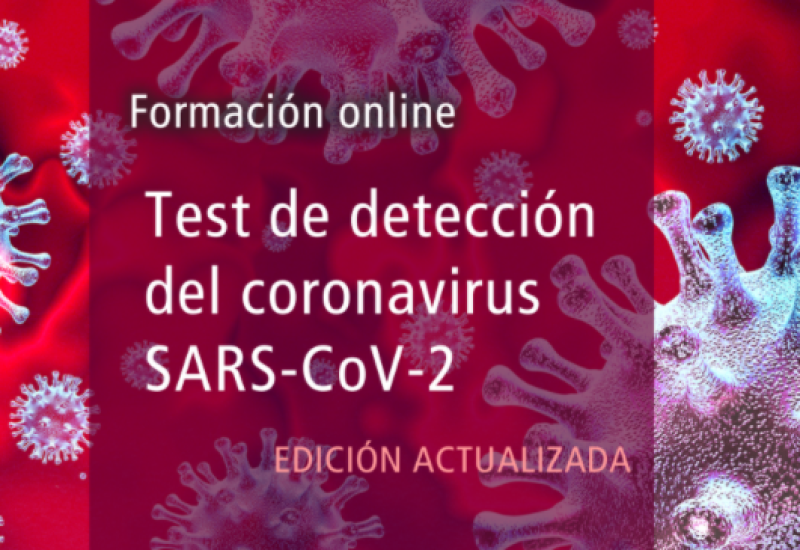 Test de detección del coronavirus SARS-CoV-2
